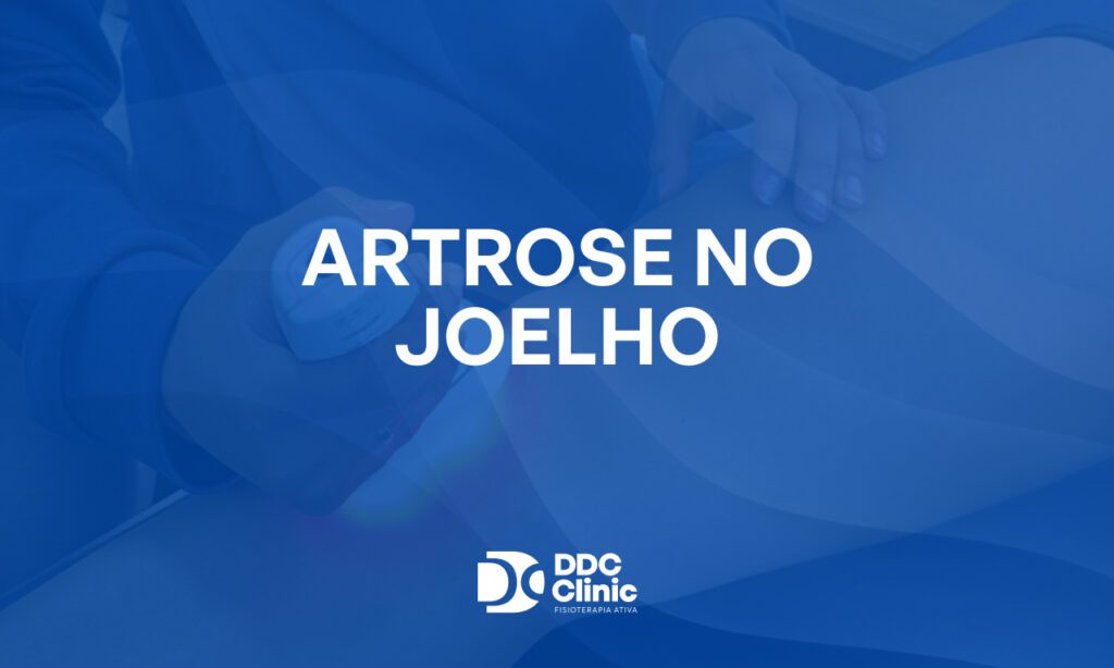 Fundo azul e com letras brancas está escrito Artrose no Joelho
